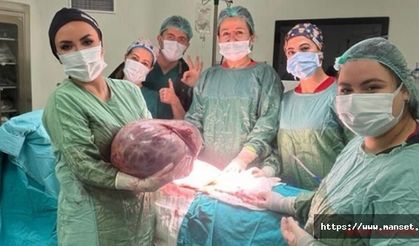 Karın şişkinliği şikayetiyle gittiği hastanede karnından 20 kiloluk kitle çıktı